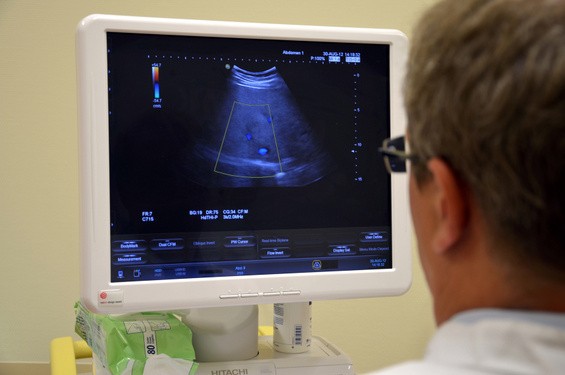 Ultraschall / Sonografie um die 20. Schwangeschaftswoche (© holgerluck/Fotolia)